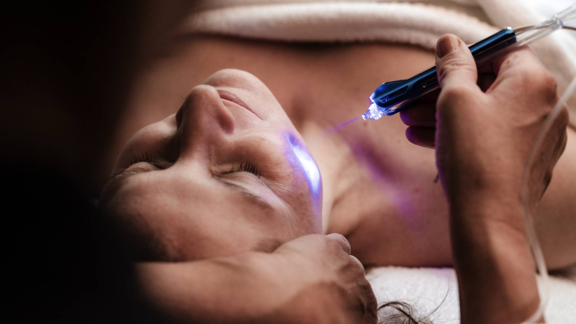 Laser-Gesichtsbehandlung
